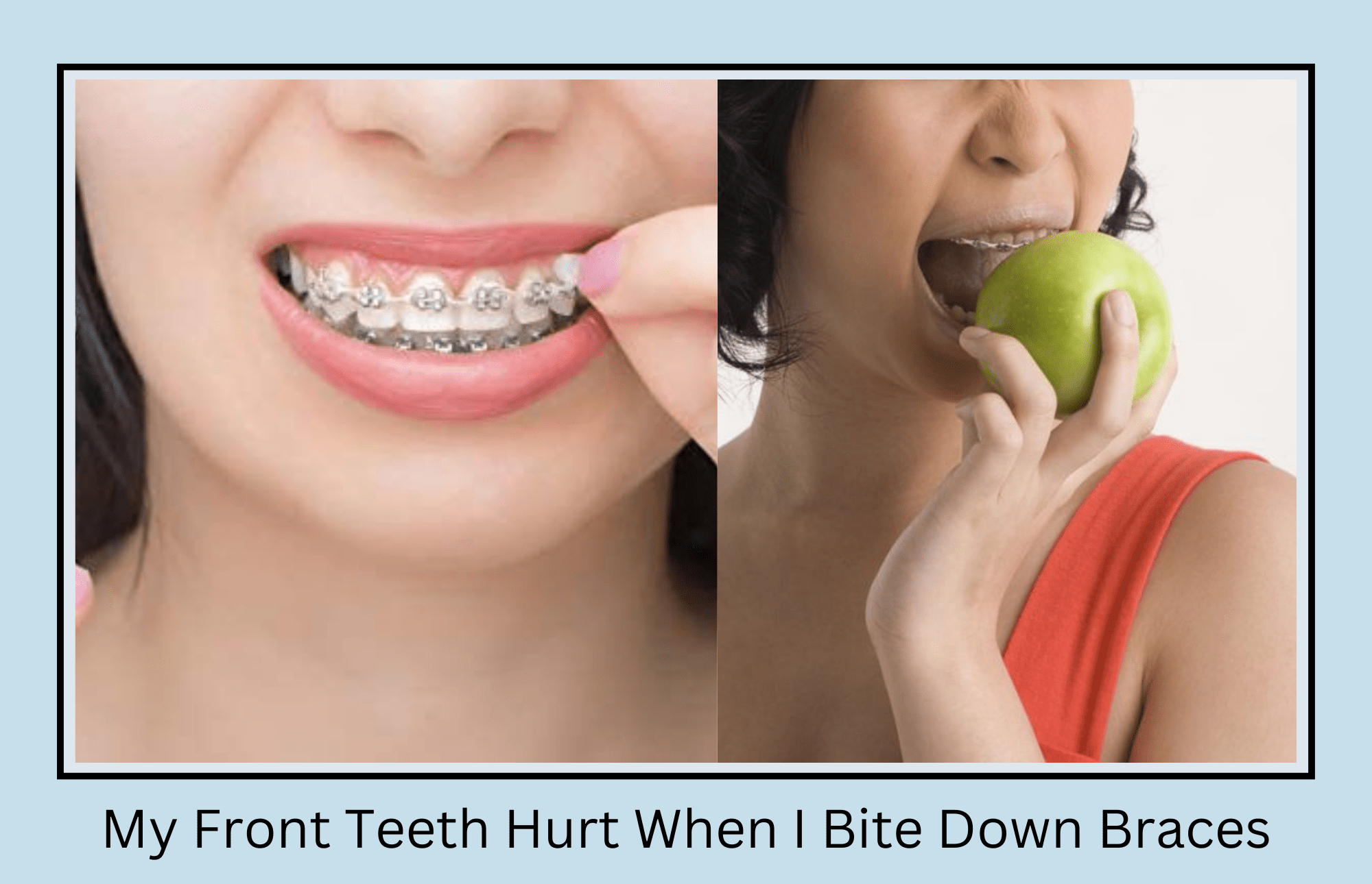 my-front-teeth-hurt-when-i-bite-down-braces-causes-and-solution-oral