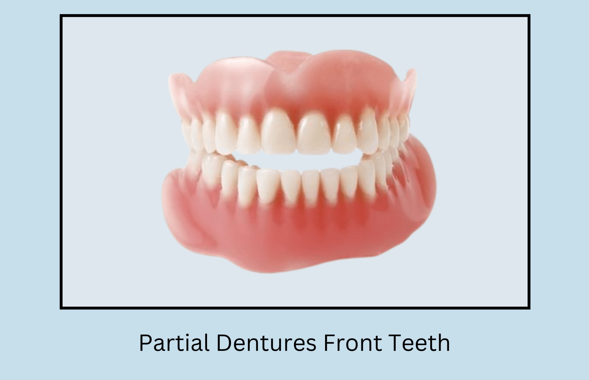 Partial Dentures Front Teeth Before and After Photos - Oral Health Line