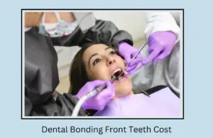 Dental Bonding Front Teeth Cost