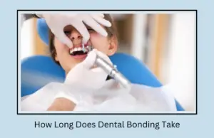 How Long Does Dental Bonding Take