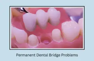 Permanent Dental Bridge Problems